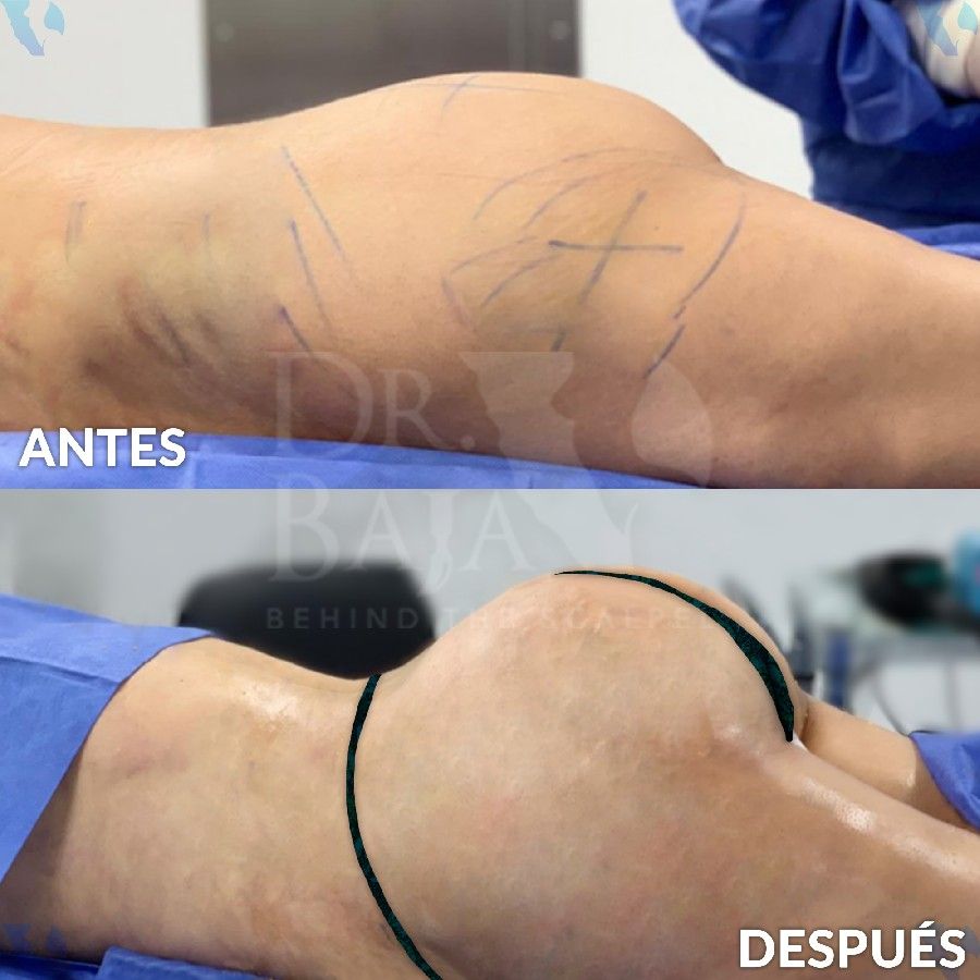 Renato Rodríguez Hirales-23