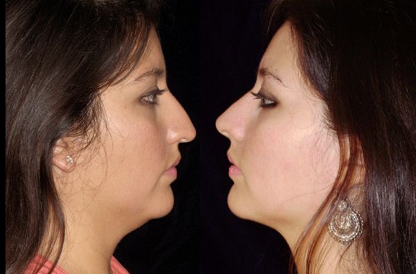 Edgar Ernesto Torres Mejía-33