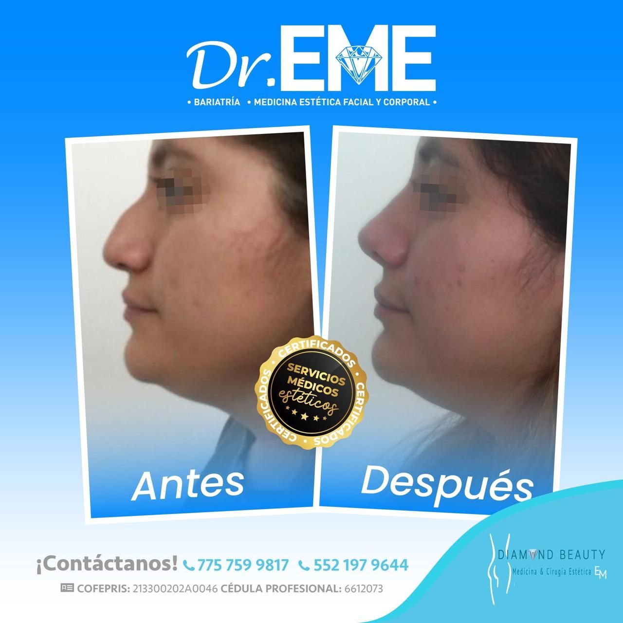 Emmanuel Mendoza Hernández-37