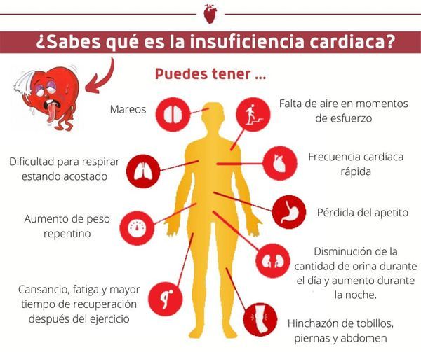 Josué Alain Hernández Rubio-8