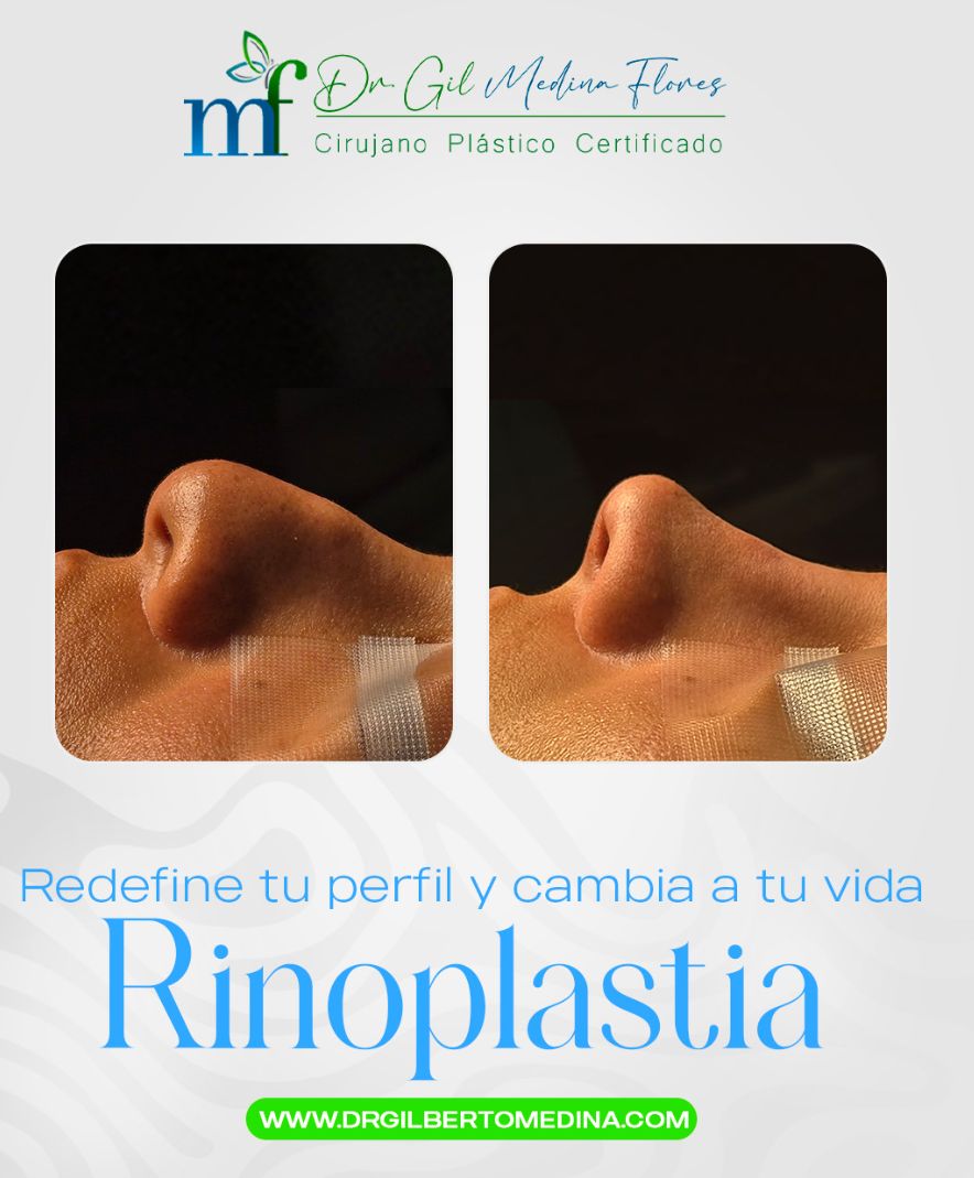 Gilberto Alfonso Medina Flores-5