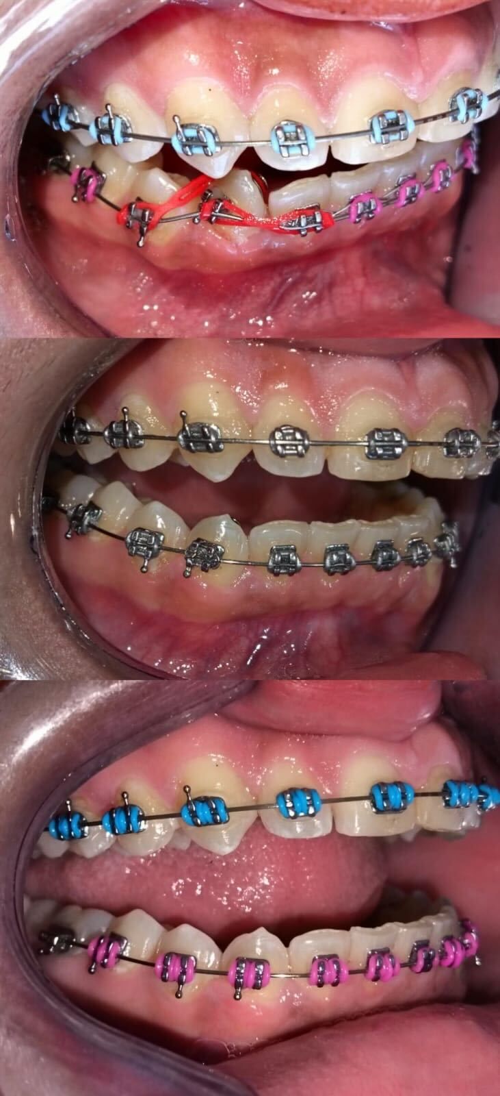 Luz Anel Valente Lozano-14