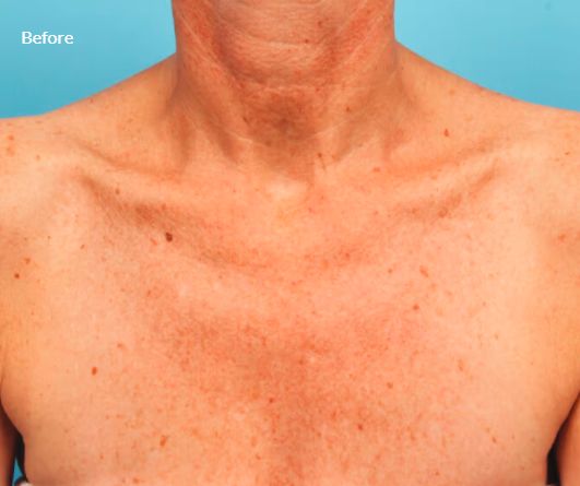 Jorge Luis Villalobos Ibarra-10