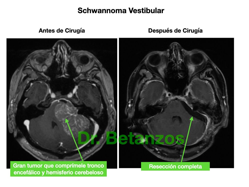 Aleixandre Betanzos Villegas-15