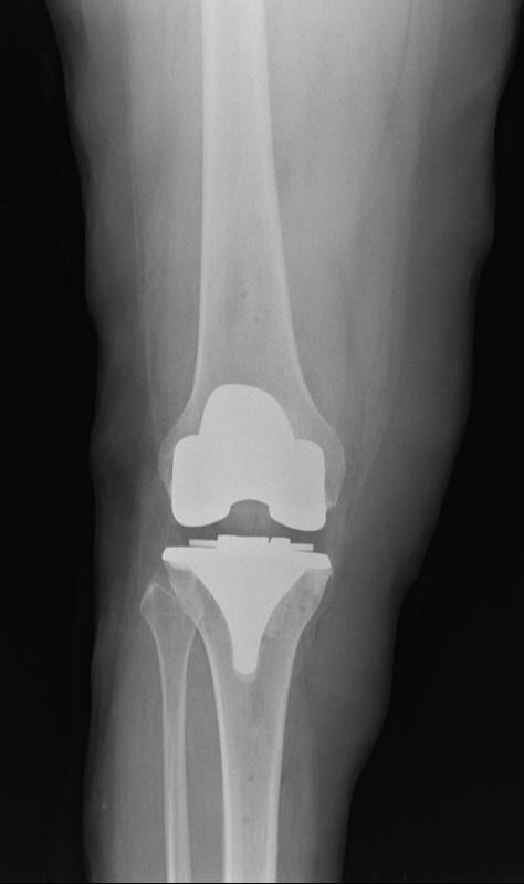 Alejandra Fuentes Martínez-12