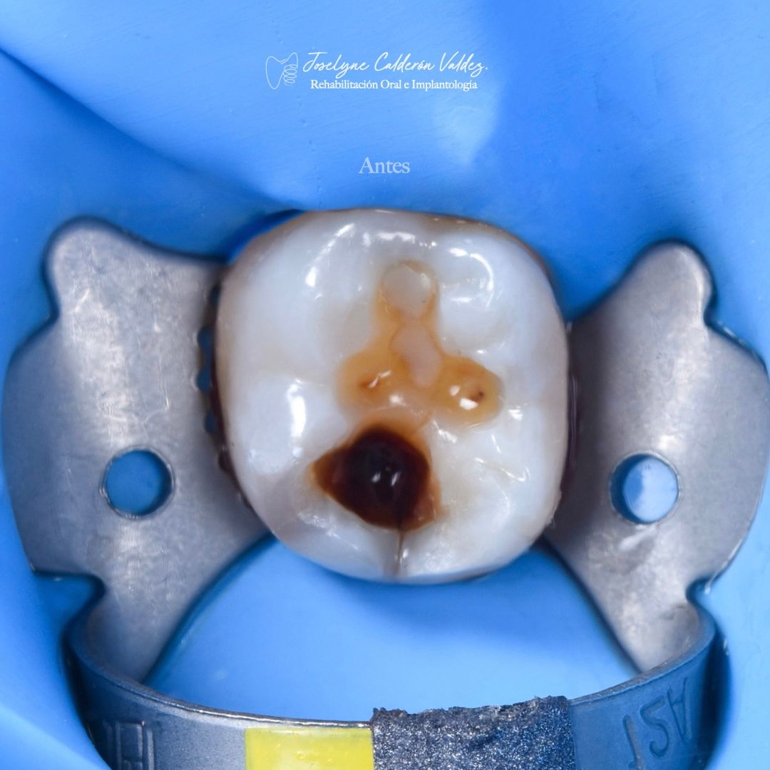 Joselyne Calderón Valdez-12