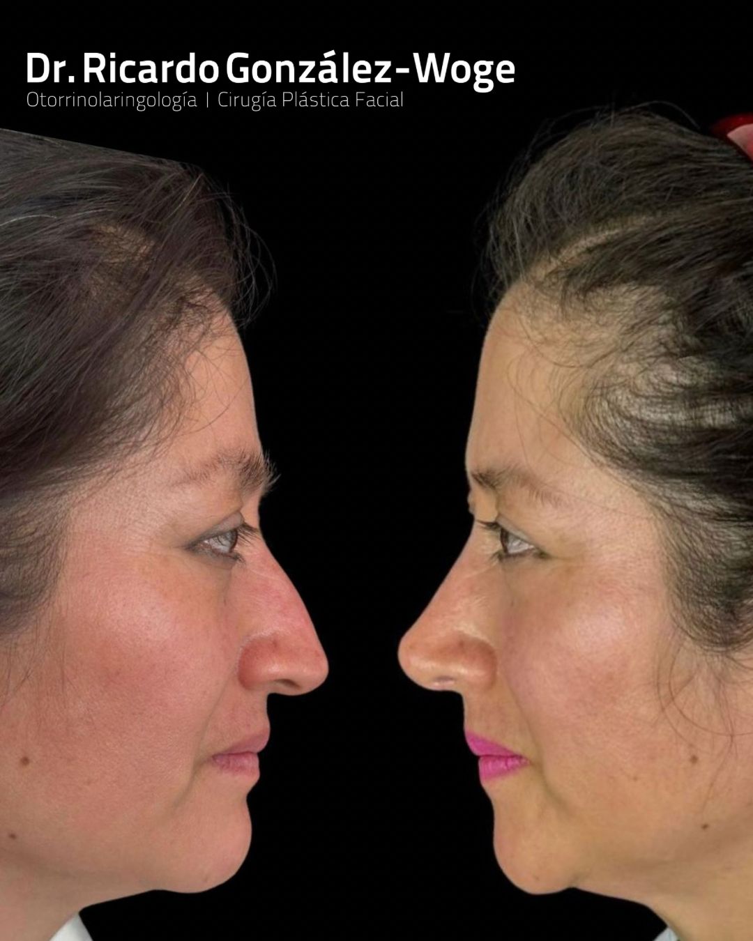 Ricardo Gonzalez Woge-16