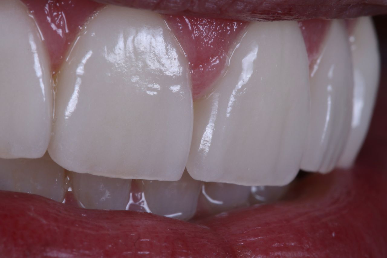 Ernesto Rojas Calderon-26