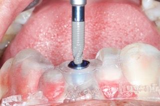 Agustin Salamanca Tapia-27