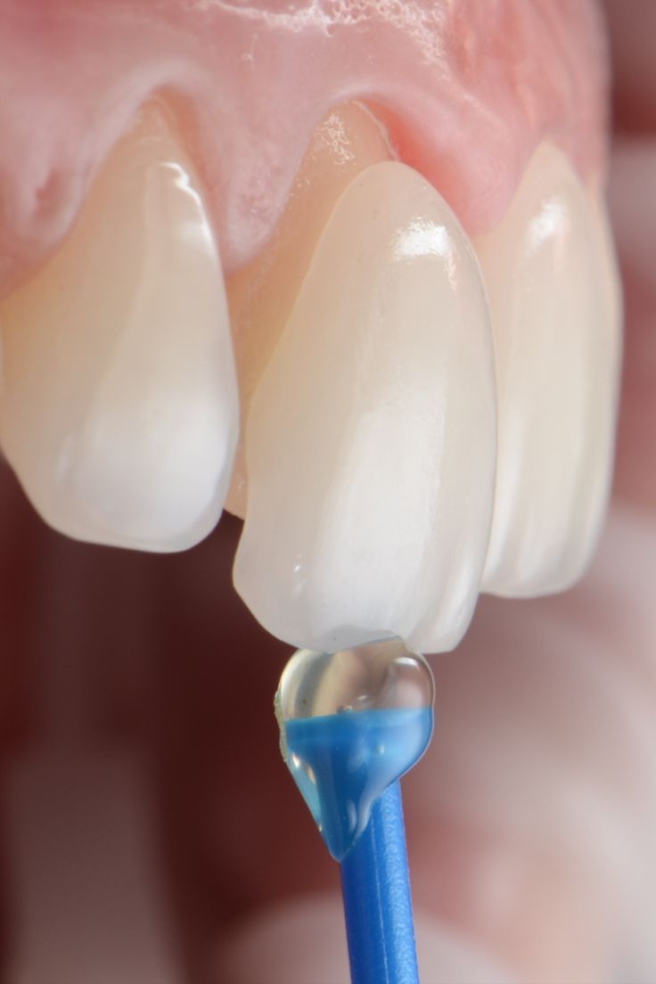 Zury Sarai Moreno Soto-7