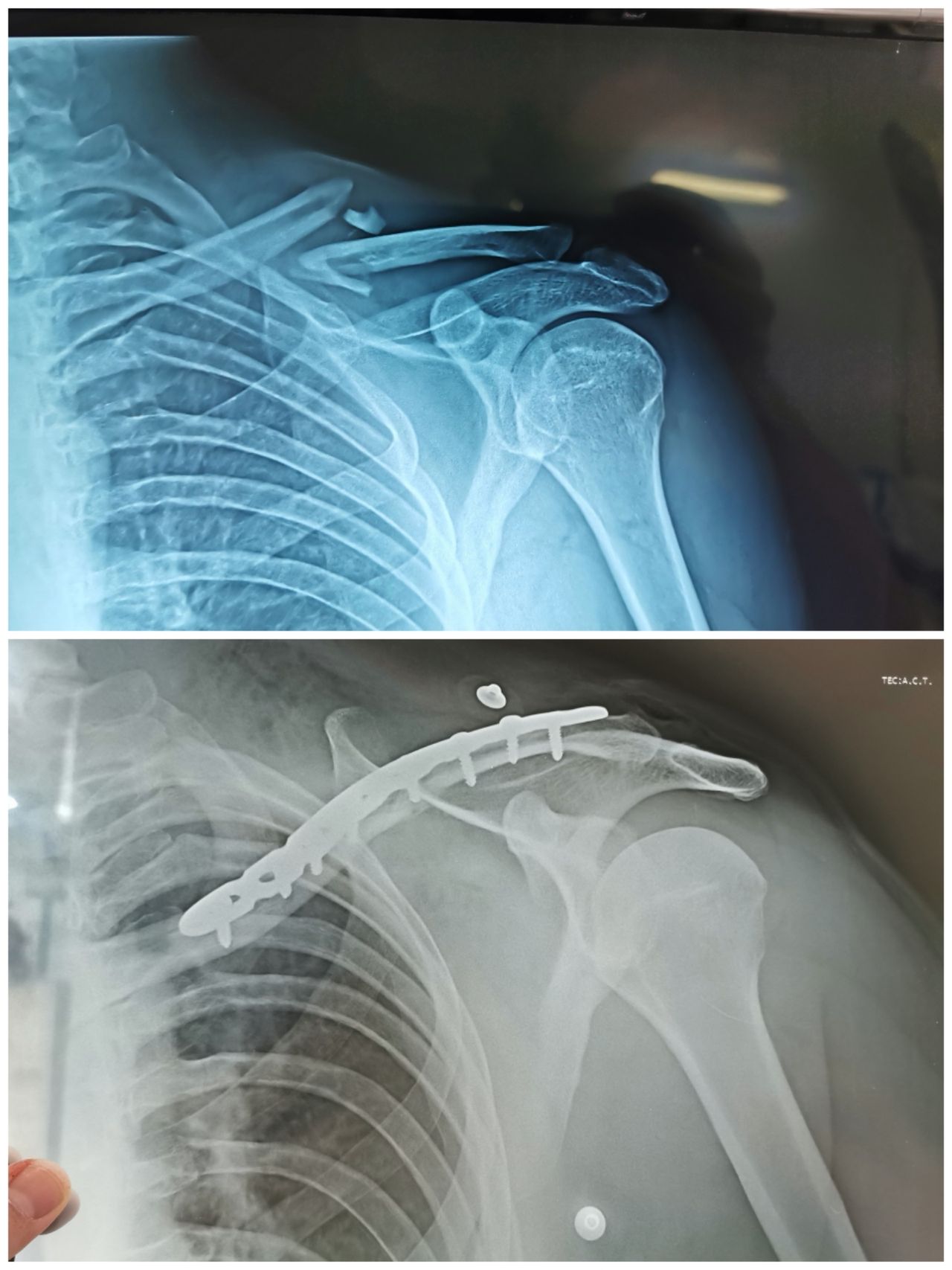 Avelino Colín Vázquez.-2