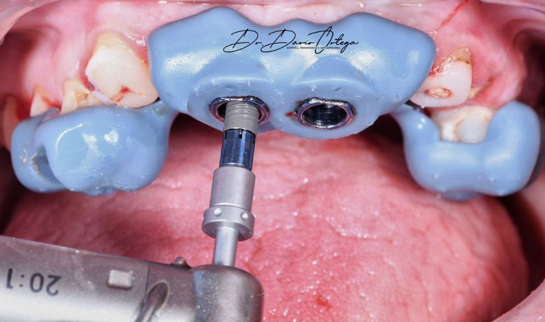 Dario Ortega Aceves-3