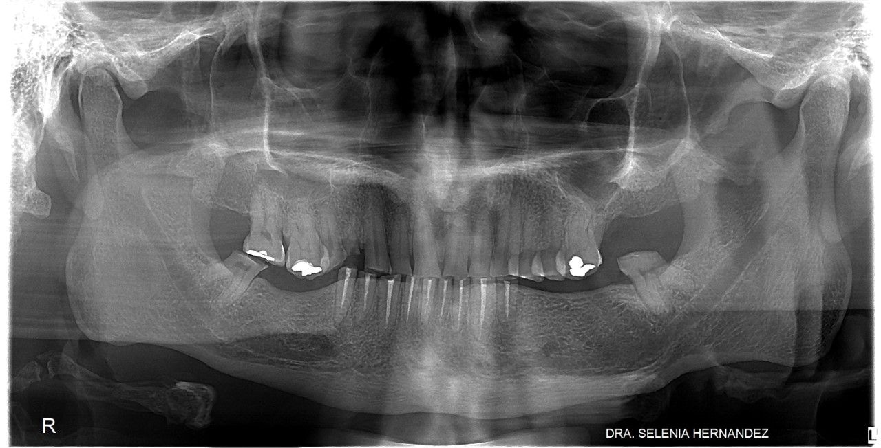Emma Selenia Hernández Castillo-18