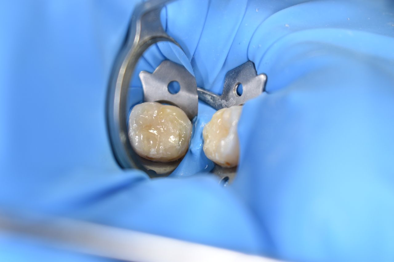 Andrea Moncada Rmz-25