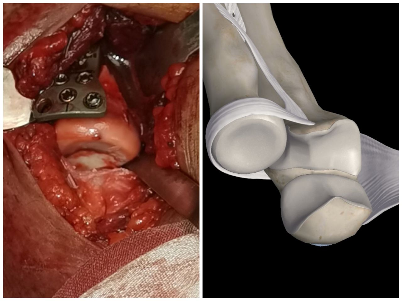 Gabriel De Leon Ochoa Lara-15