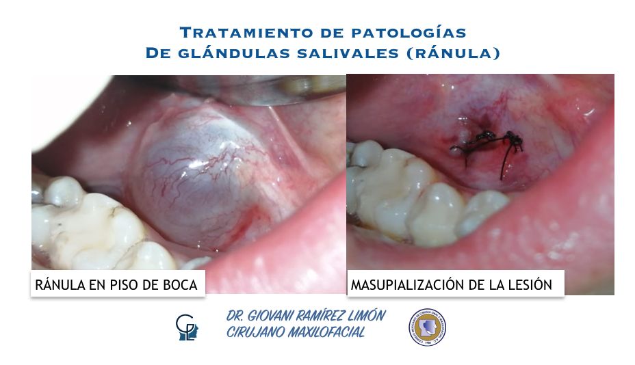 Giovani Ramírez Limón-35