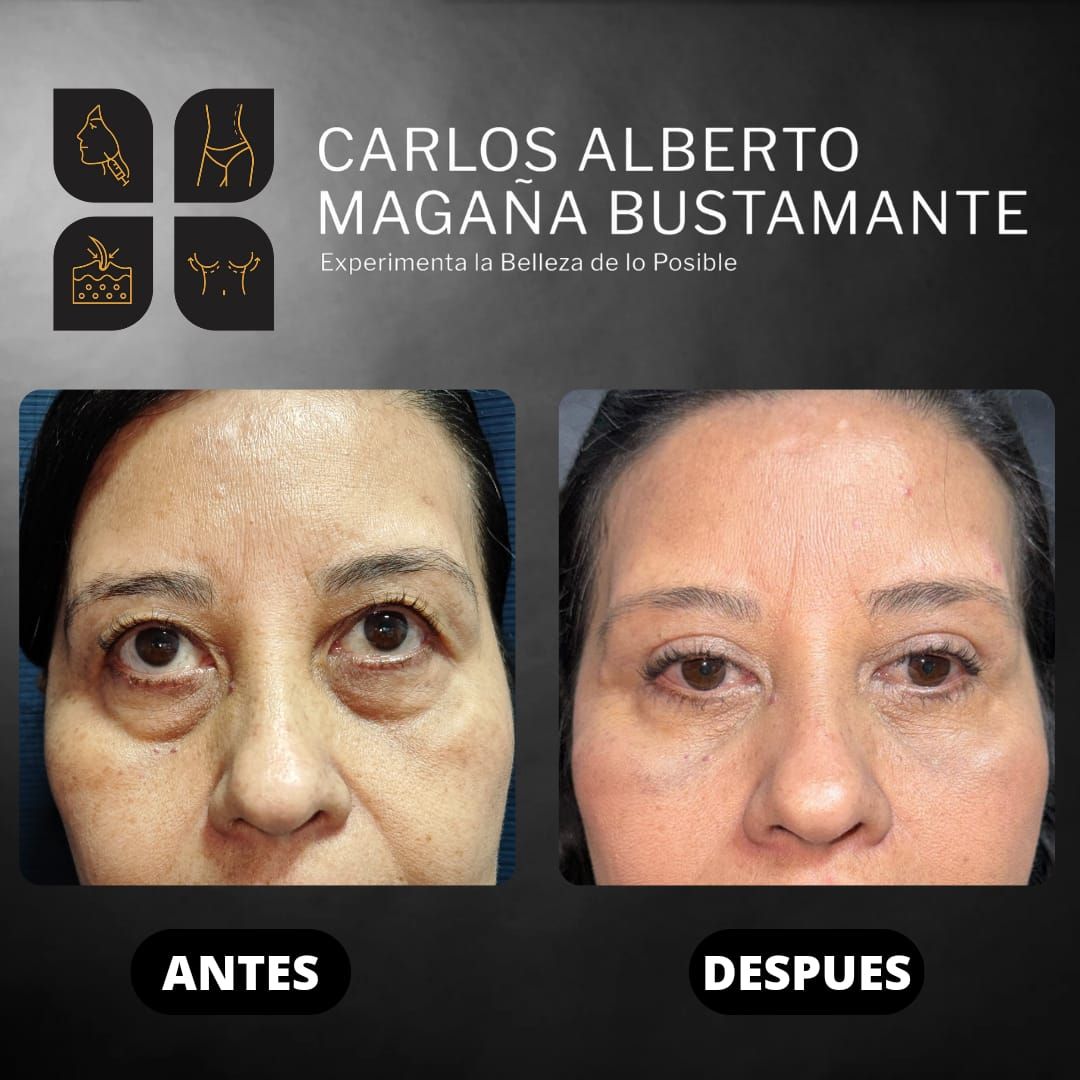 Carlos Alberto Magaña Bustamante-10