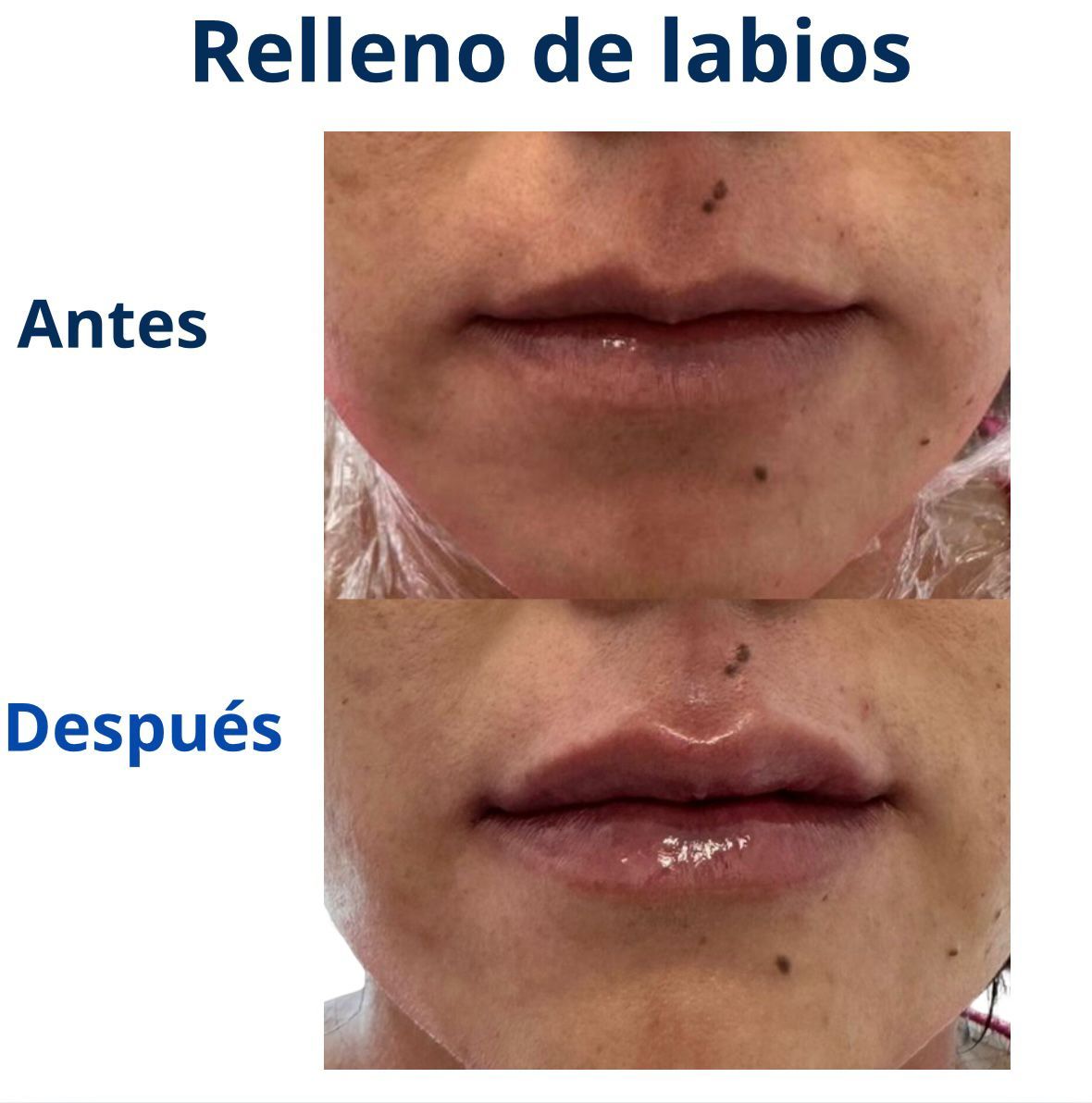 Itzel Anayn Flores Reyes-23