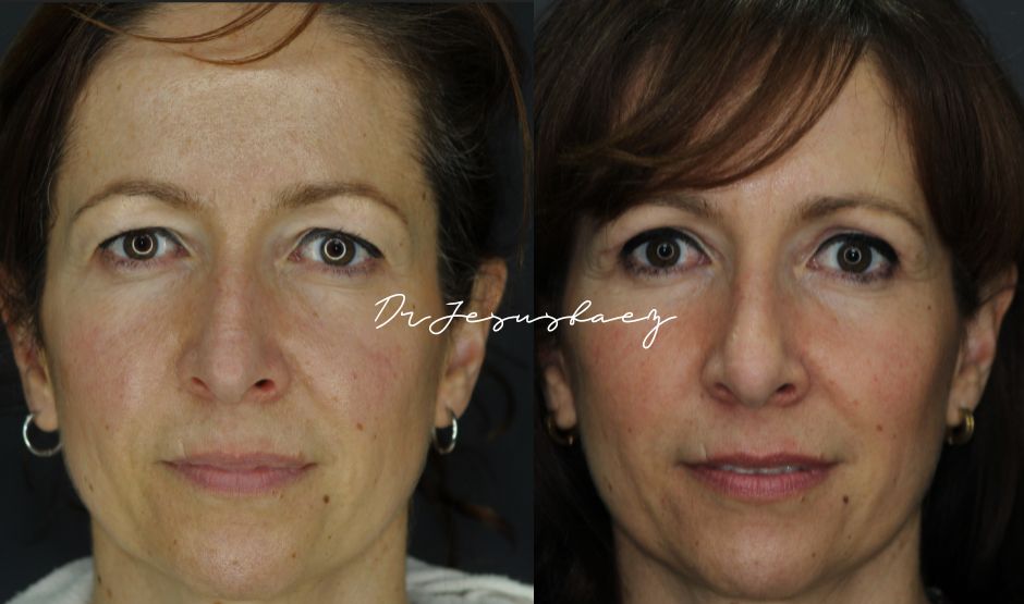 Jesús Báez Márquez-8