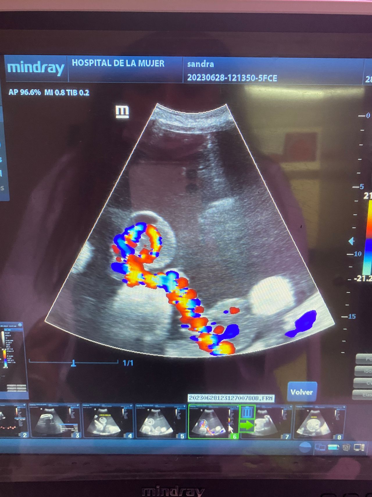 Amairani Yaneiri Mercado Rivera-13