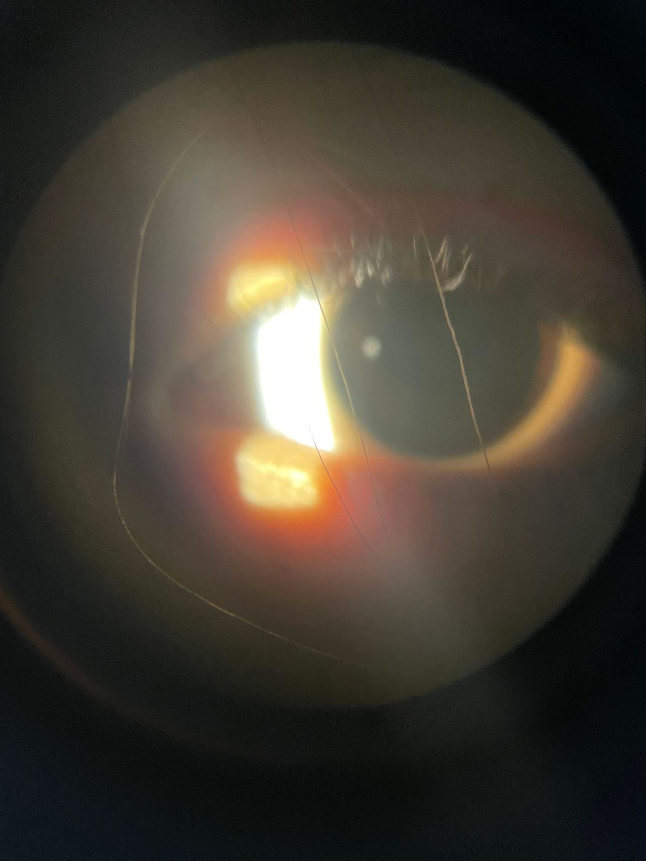 Anneé Miranda Carracedo-1