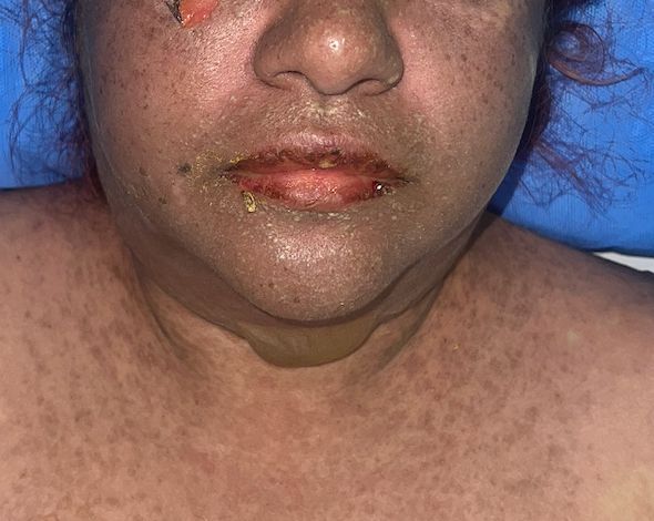 Lauro Francisco Varela Coronado-13