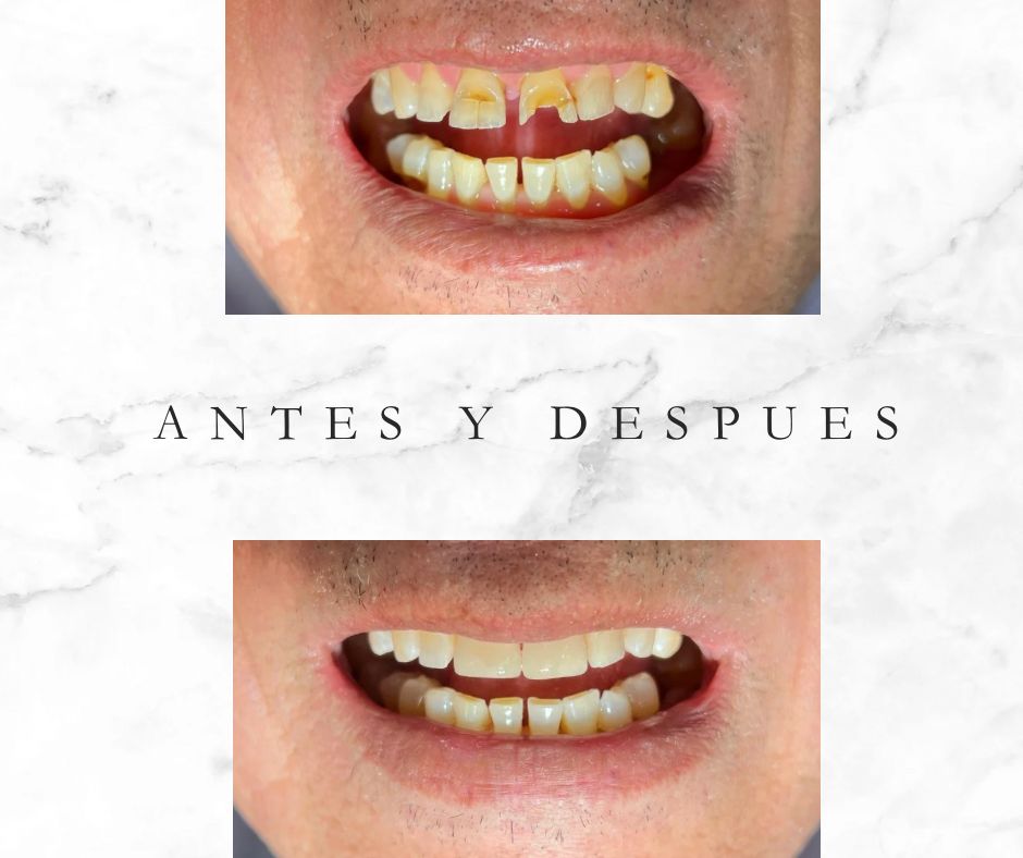 Noe Arturo Cortazar Sánchez-5