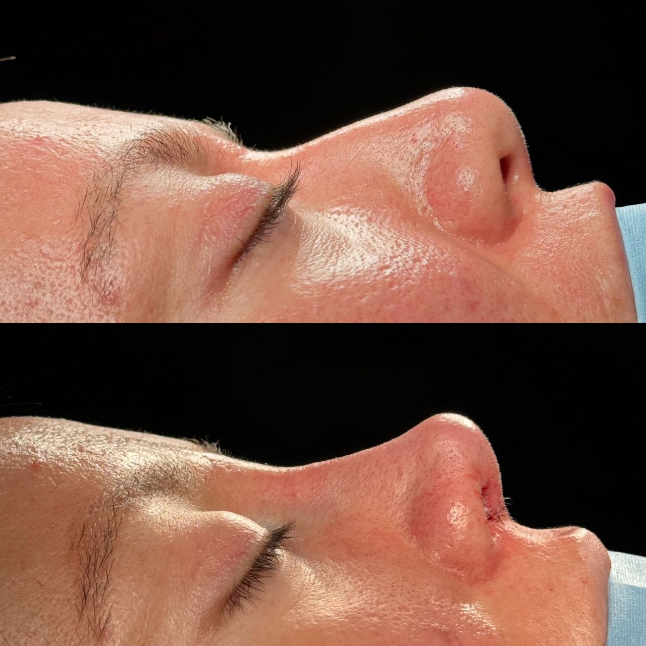 Angel Castro Urquizo-135