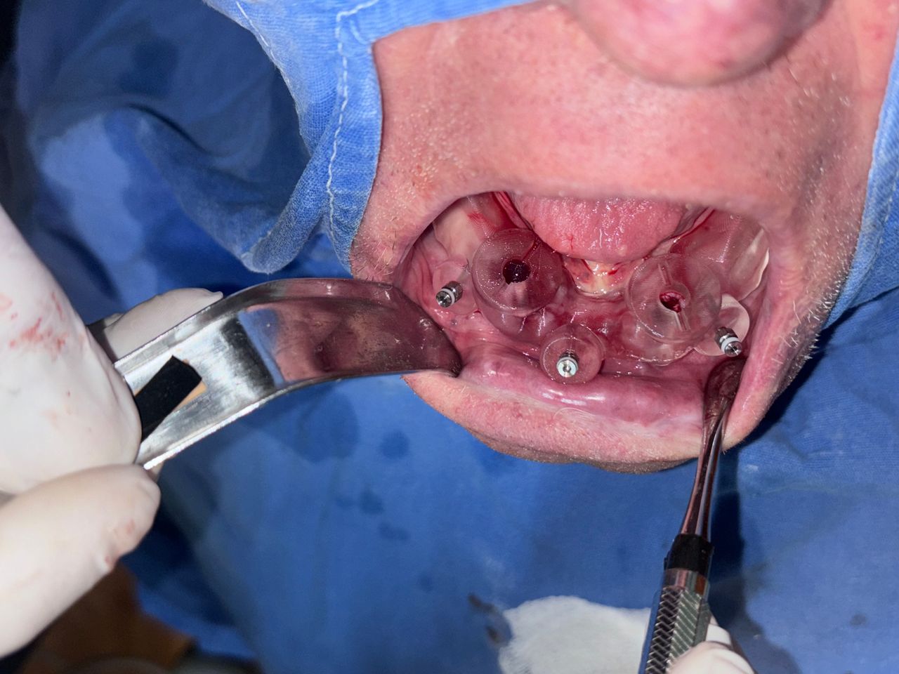 Diego Alan Cardiel Caraveo-8