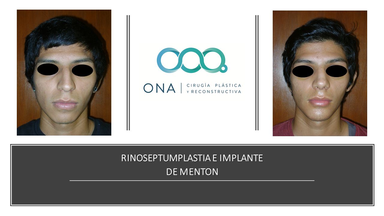 José Luis Segura Castillo-14