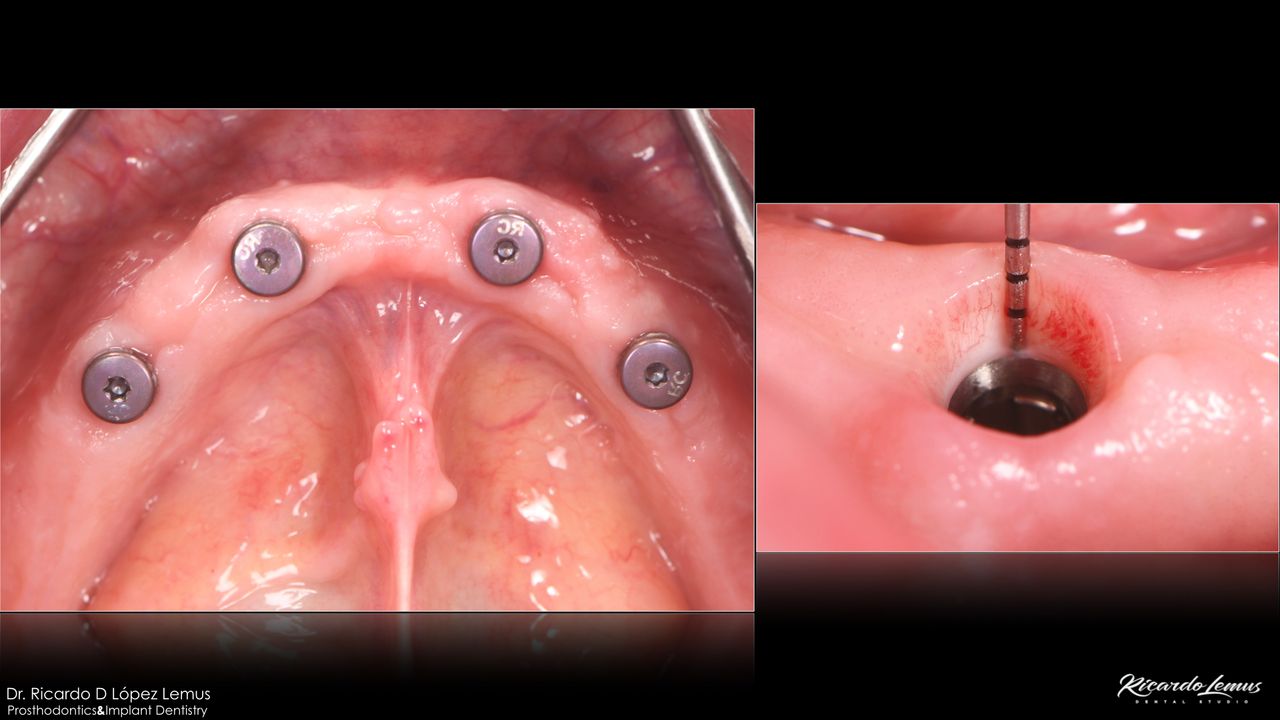 Ricardo López Lemus-67