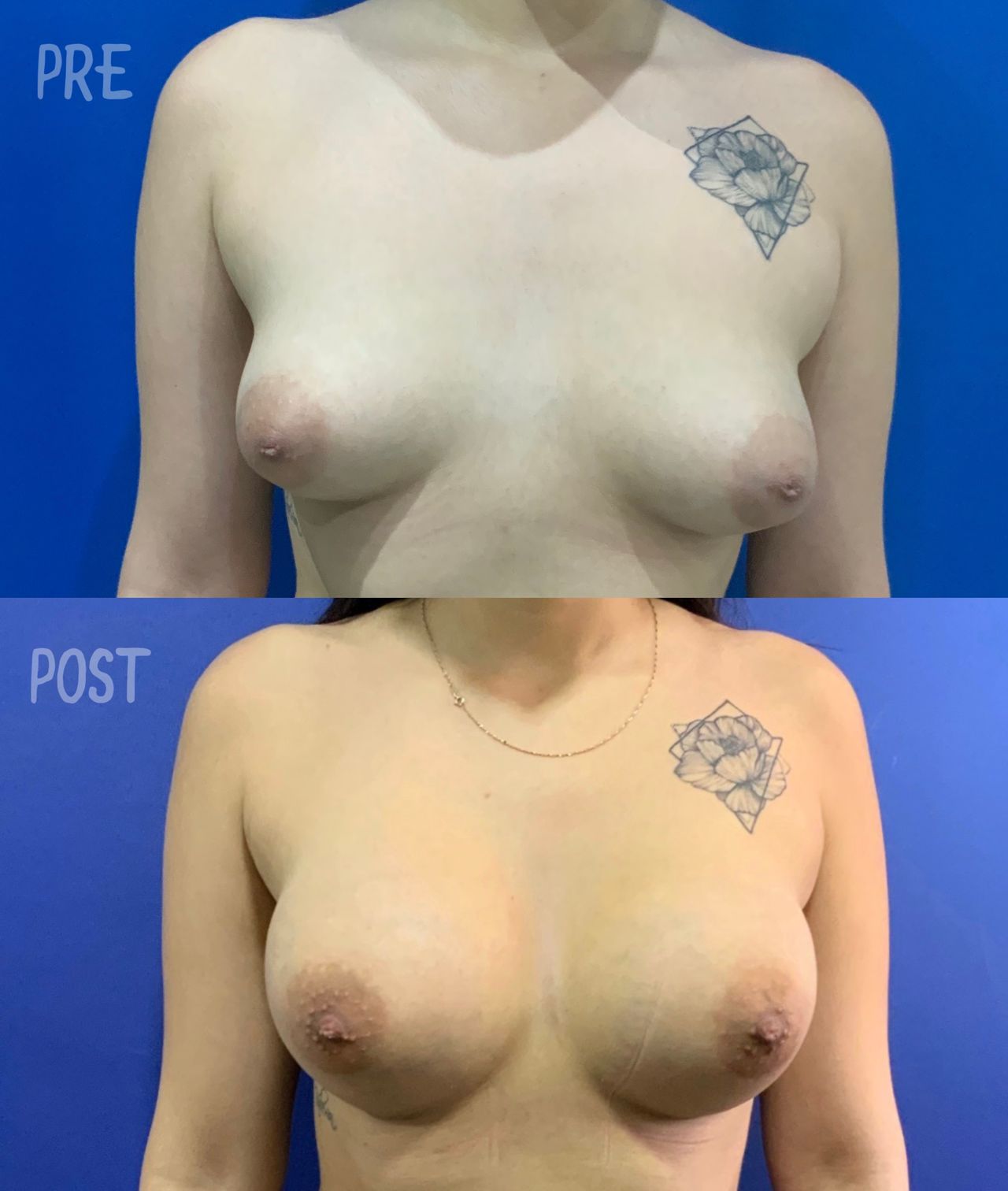 Giuseppe Tanzillo-52