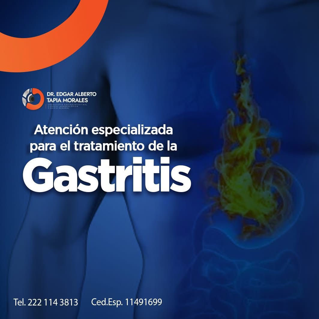 Edgar Alberto Tapia Morales-47