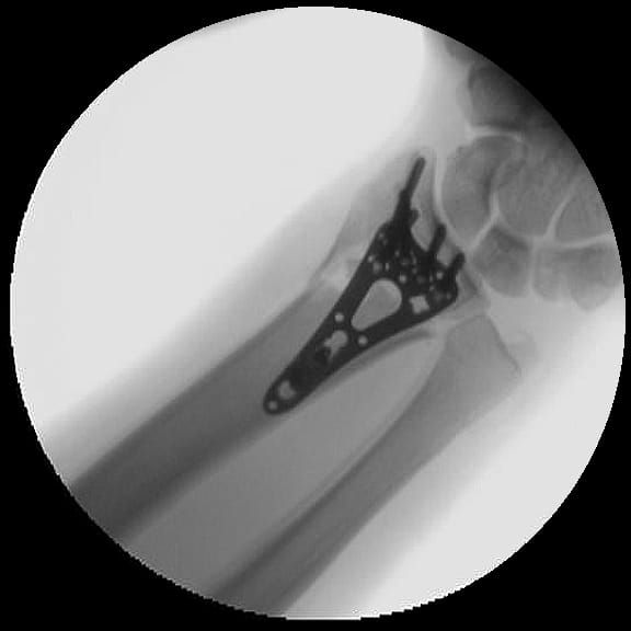 Rafael Adolfo Ferreyra Martinez-6