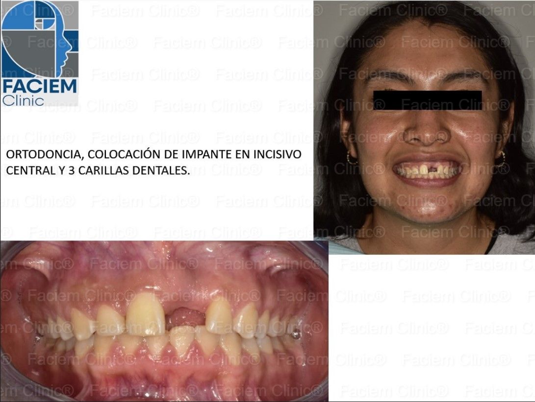 Arlen Colín Ordaz-12