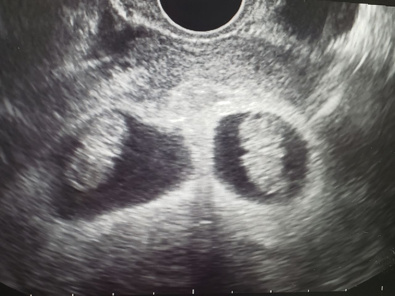 Marisol I. Alvarez Carrasco-46