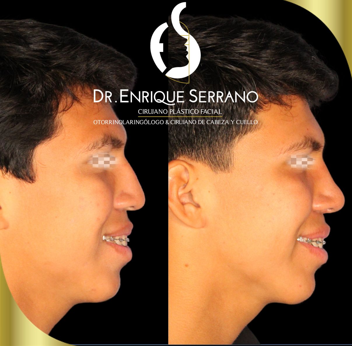 Enrique Serrano Cruz-10