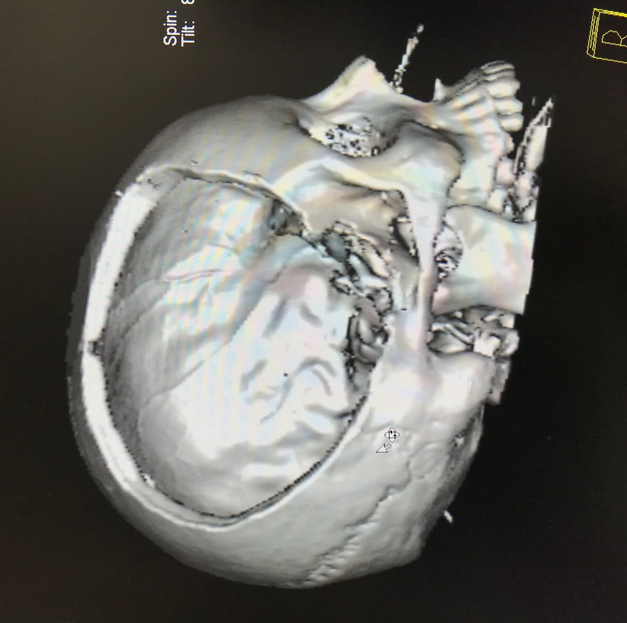 Rafael Maciel Morfin-47