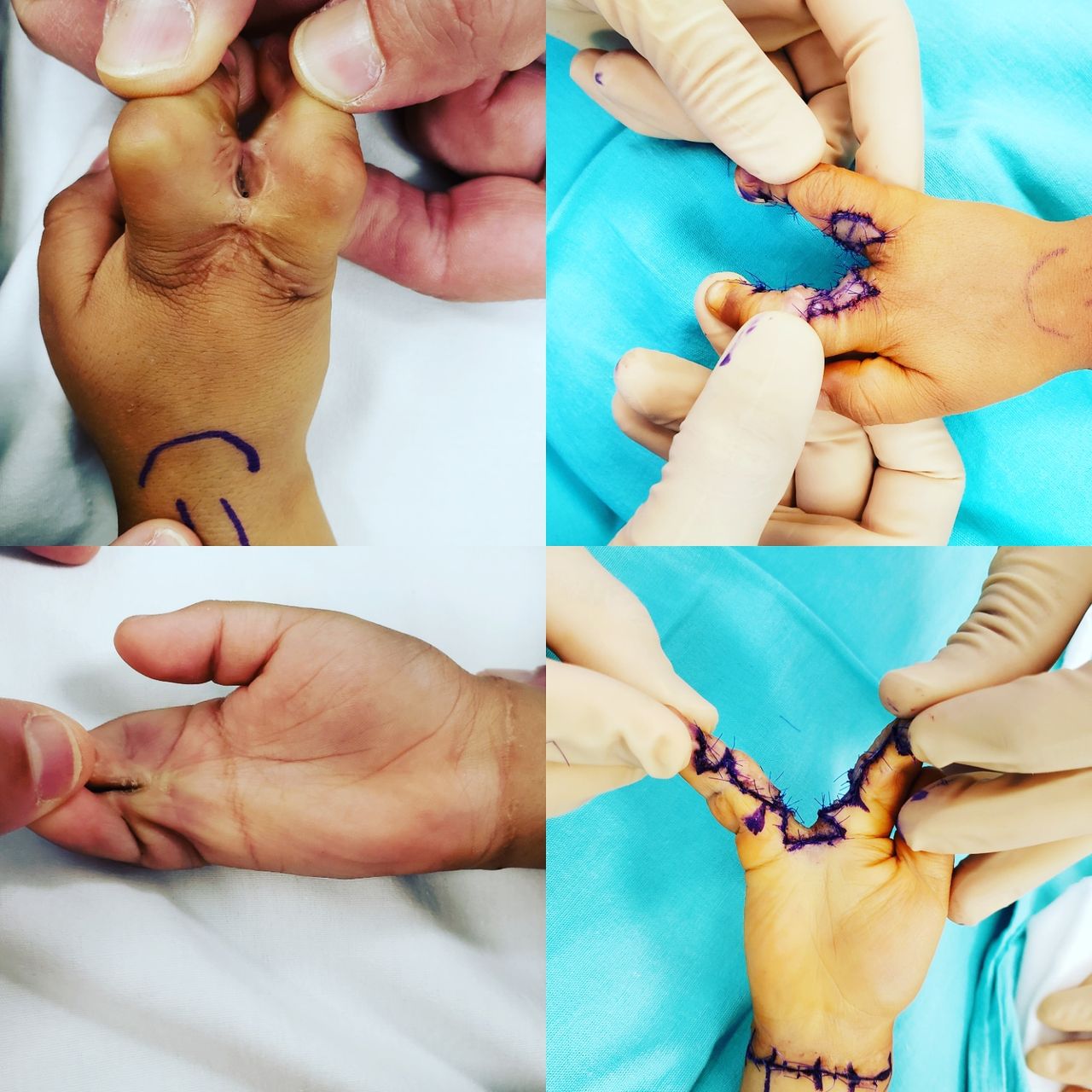 Alfonso Meza Vernis-69