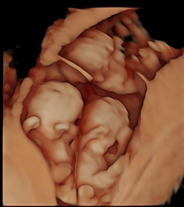 Iván André Guzmán Amador-7