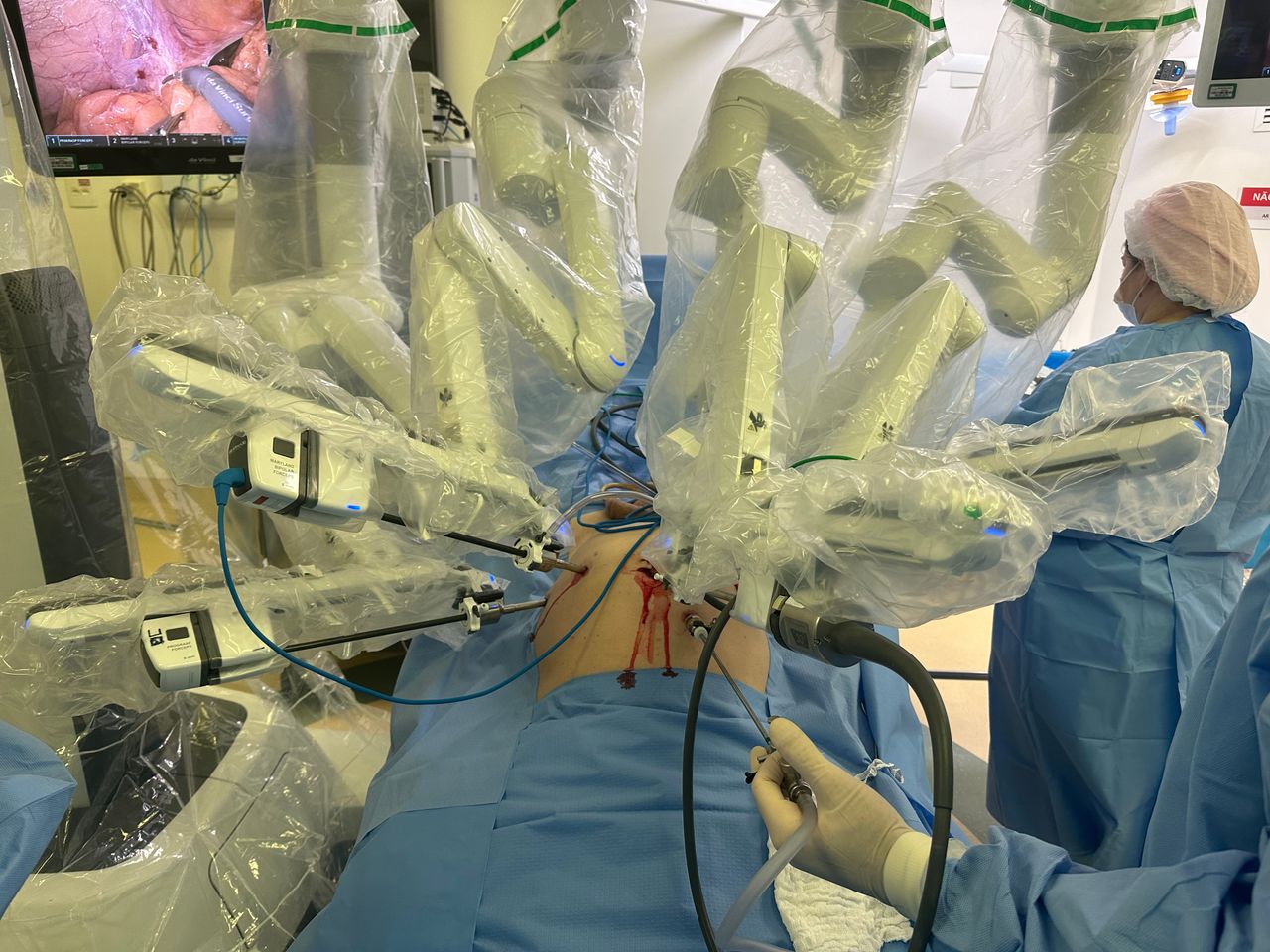 Humberto Olmedo Pérez-5