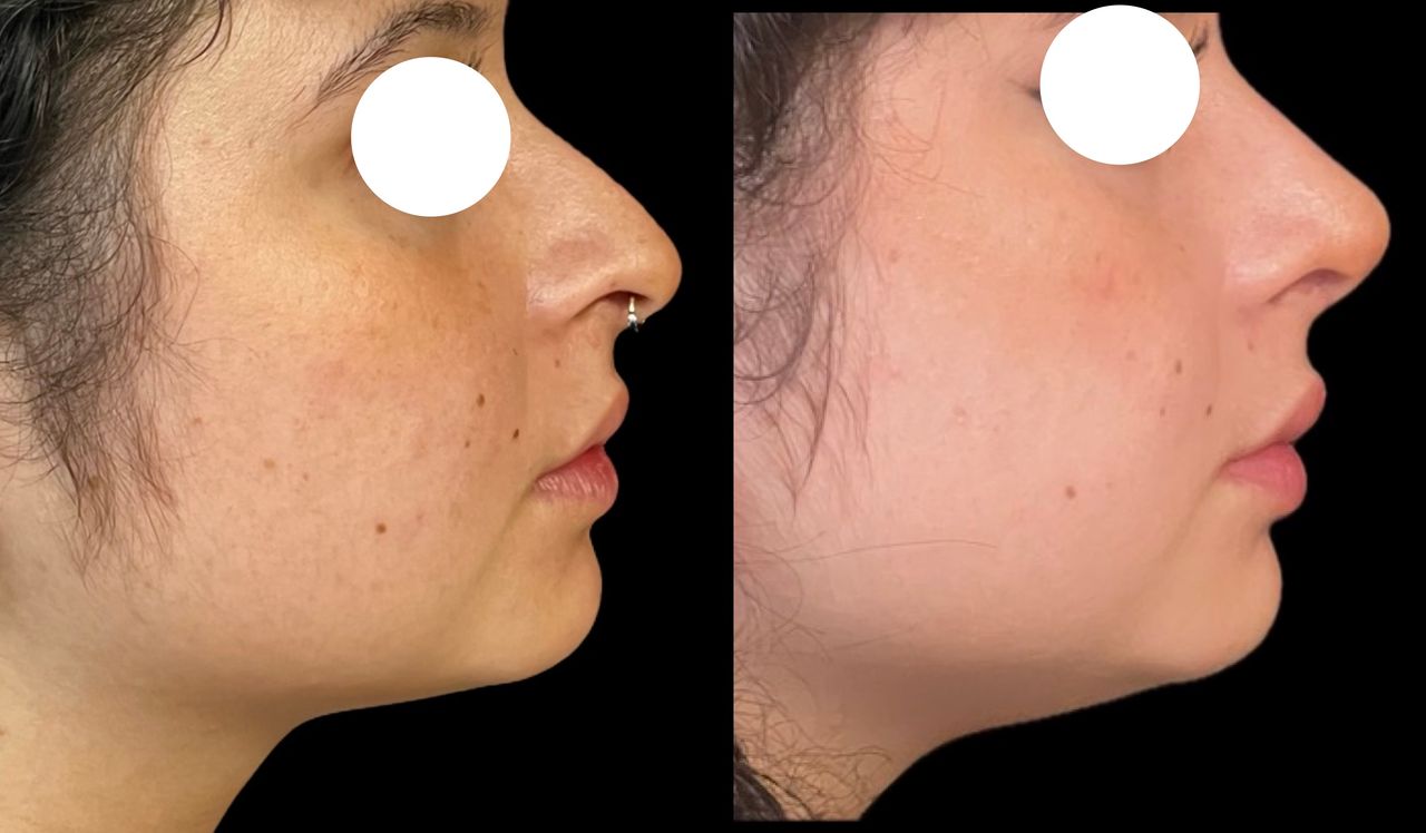 Ana Milagros Chávez Velázquez-2