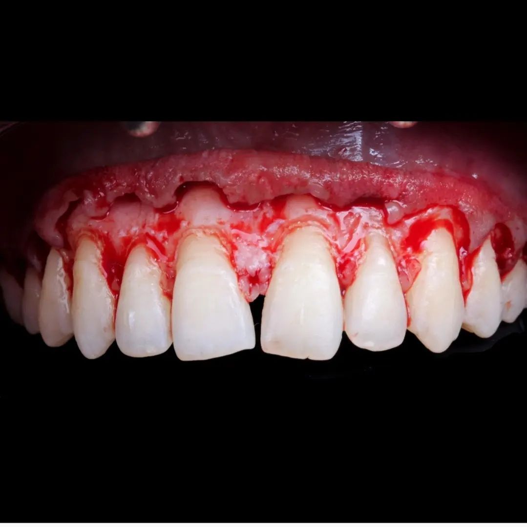 Hugo Enrique Aguilar Lamas-55