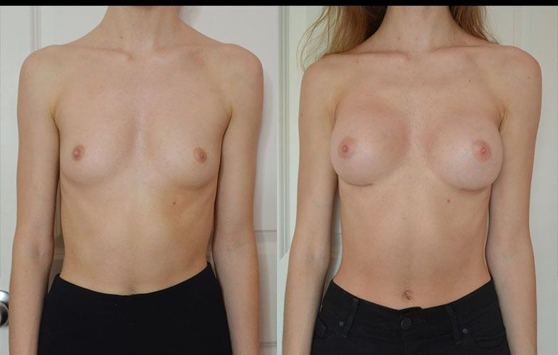 Edgar Ernesto Torres Mejía-13