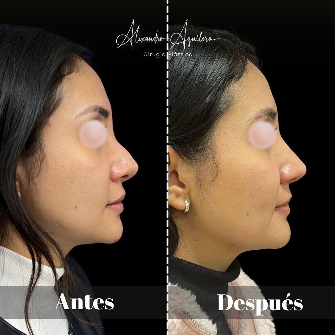 Alexandro Aguilera Salgado-26