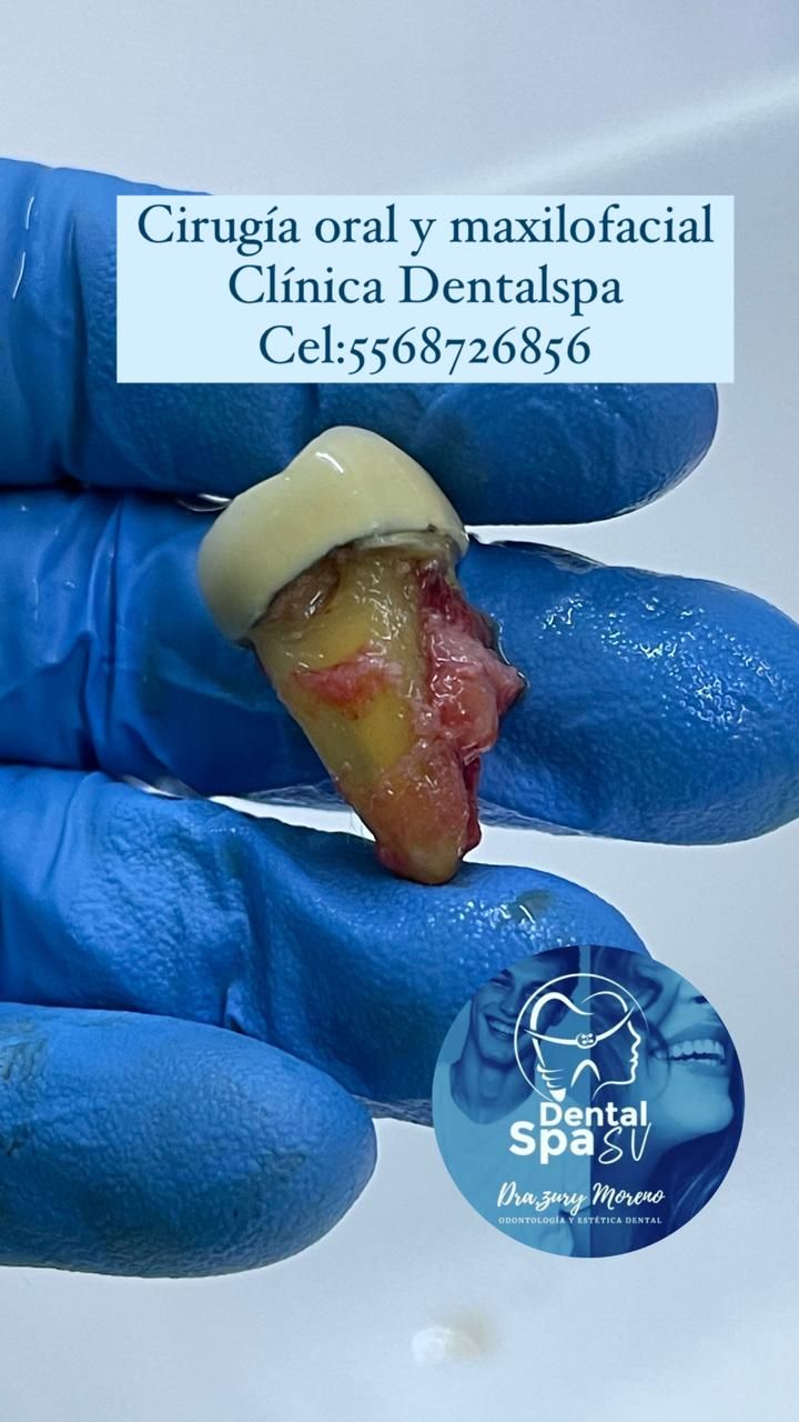 Zury Sarai Moreno Soto-11