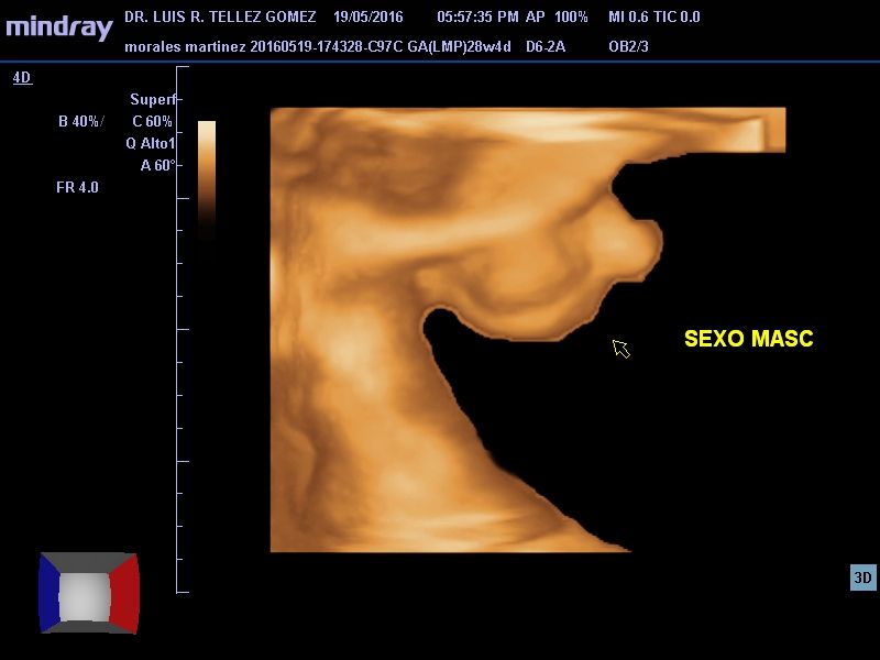 Luis Reynerio Téllez Gómez-4