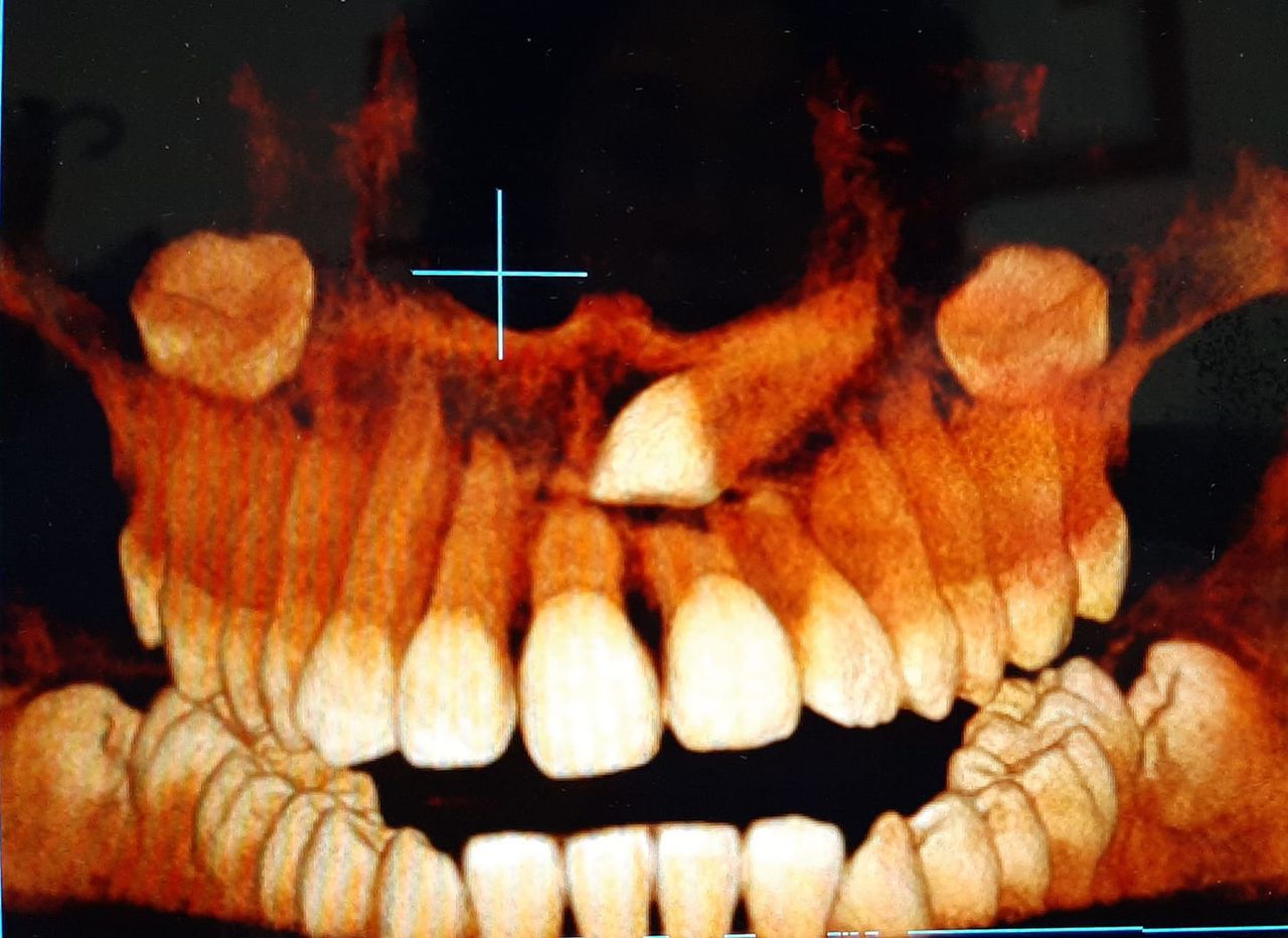 Zeyda Oliman Hoyos-10