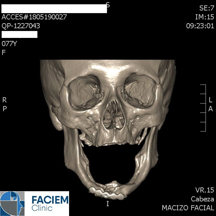 Arlen Colín Ordaz-53