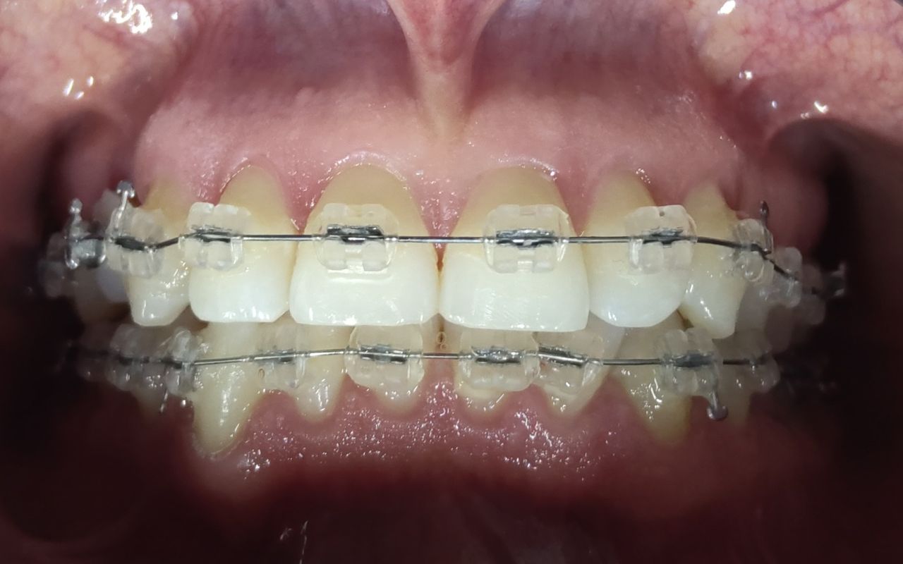 Jair Contreras García-7